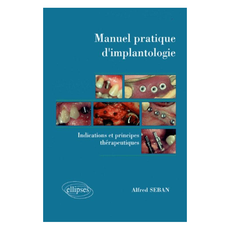 Manuel pratique d'implantologie - Indications et principes thérapeutiques