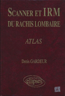 SCANNER IRM RACHIS LOMB.ATLAS