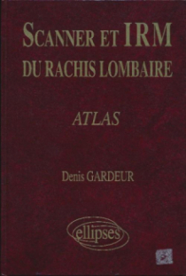 SCANNER IRM RACHIS LOMB.ATLAS